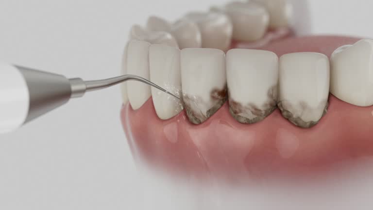 Reliable Dental Implants contractor in Walnut, CA by Smile Center Dentistry